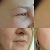 Image 2: Facial, Arm, Abdominal, or Back Contour Experiences