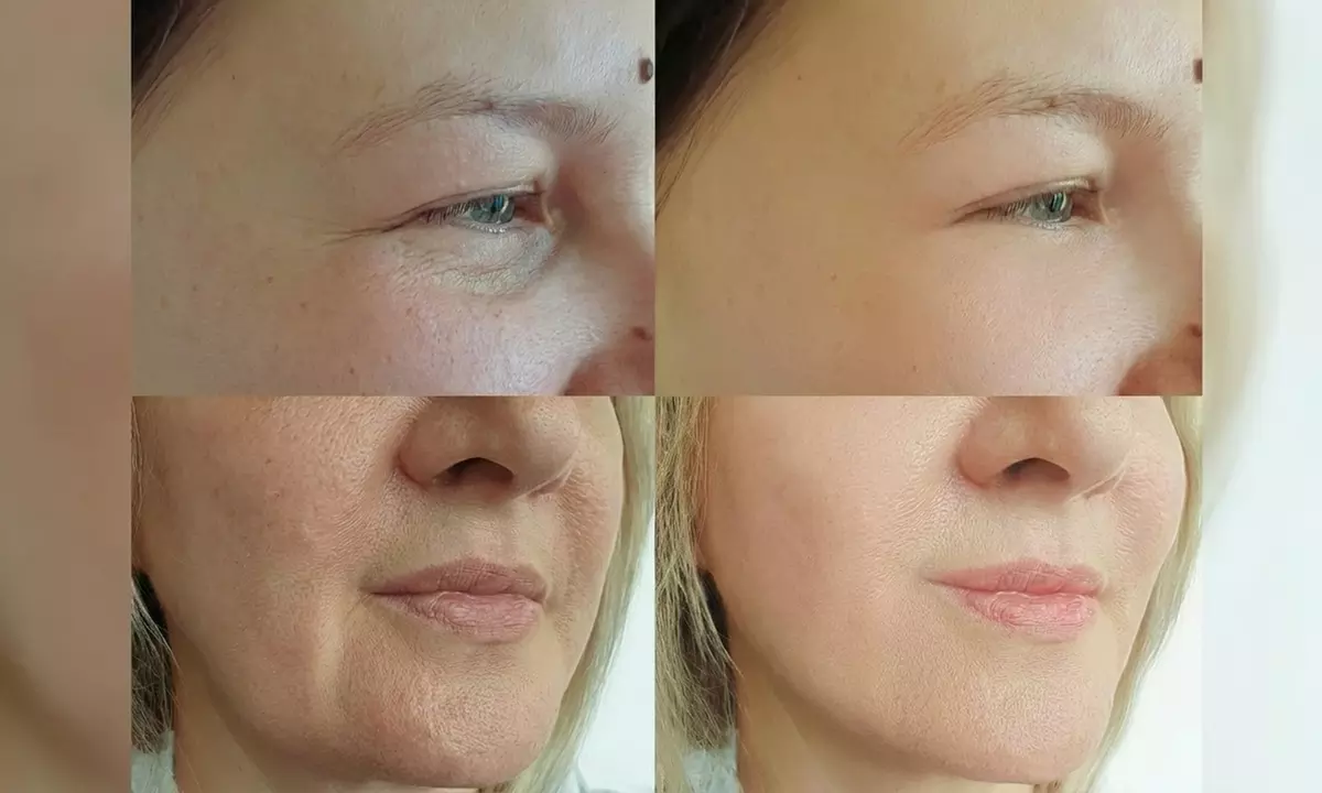 Facial, Arm, Abdominal, or Back Contour Experiences