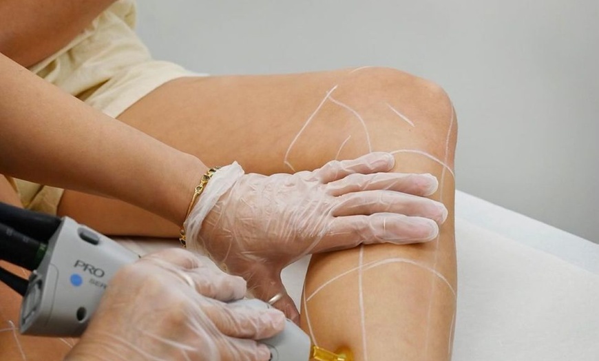 Image 8: Get Laser Hair Removal for Bikini, Brazilian, Legs, Neck & More