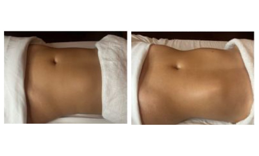 Image 4: One or Three Brazilian Drainage-60-Minute Massage at Albina beauty & massage (Up to 48% Off)