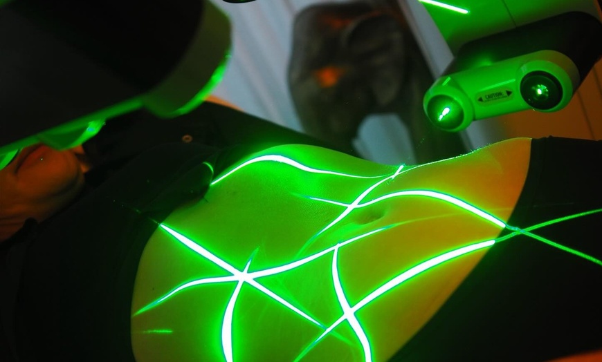 Image 5: Tone with One, Four, Eight, Twelve or Sixteen of Emerald Laser Package