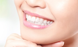 Sonrisas relucientes con empastes y limpieza bucal profesional