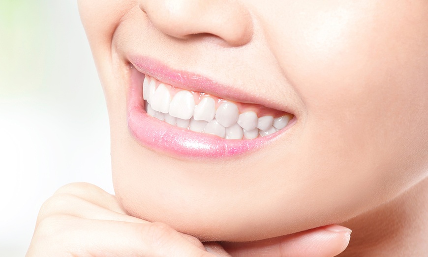 Image 1: Sonrisas relucientes con empastes y limpieza bucal profesional