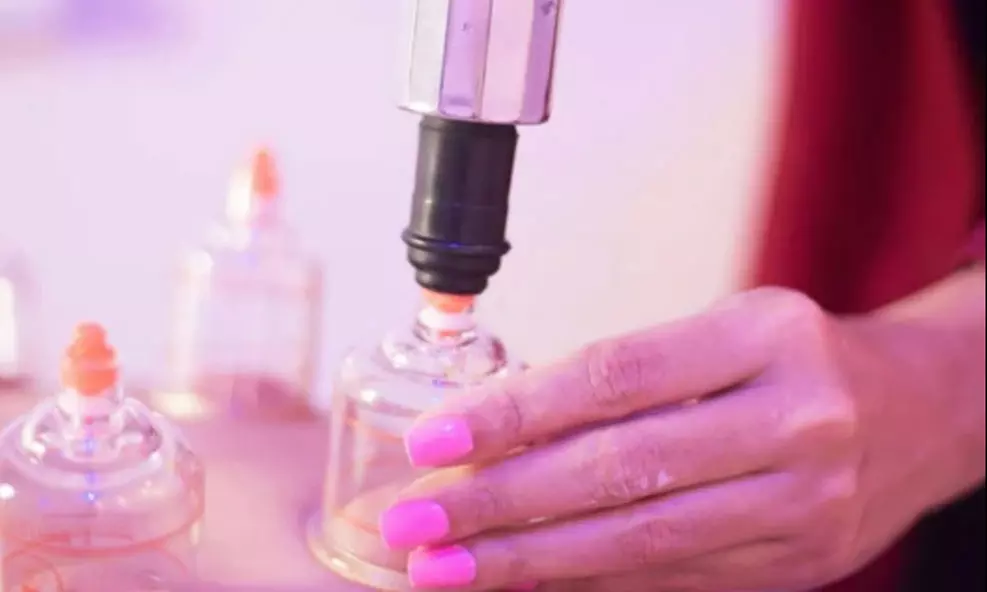 Experience Cupping Treatment with Custom massage 50-or 80-mins