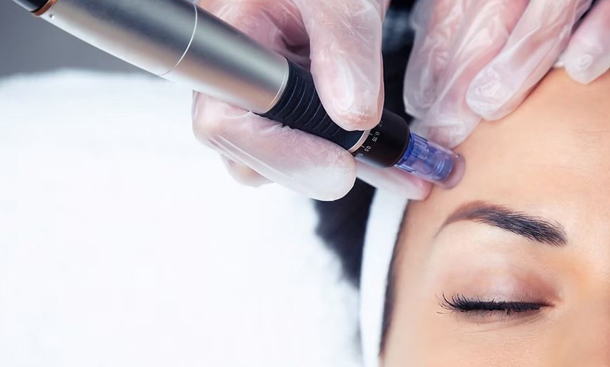 Image 5: Dr Murad-Technoceuticals Peel/Skin Booster-Microneedling & Dermaplane