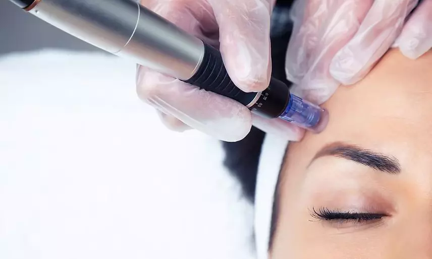 Dr Murad-Technoceuticals Peel/Skin Booster Package-Microneedling & Dermaplane at Just Aesthetics (Up to 62% Off) - Second Medium