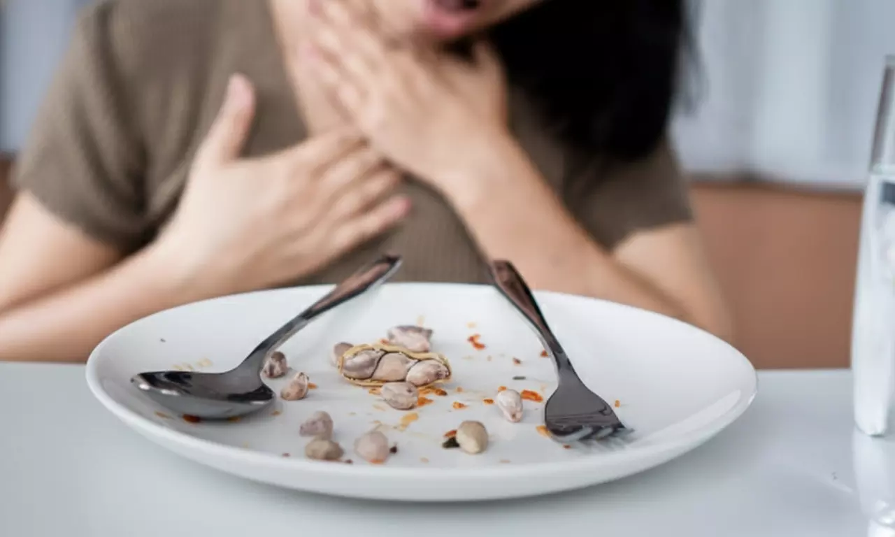 Learn & Master Food Allergen or Hygiene and Safety Level 1,2 & 3 Online Courses Up to 56% Off at Compete High - Primary Image