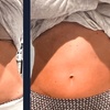 Image 3: Cryoslimming Body Sculpting – 1, 3, or 5 Session Packages