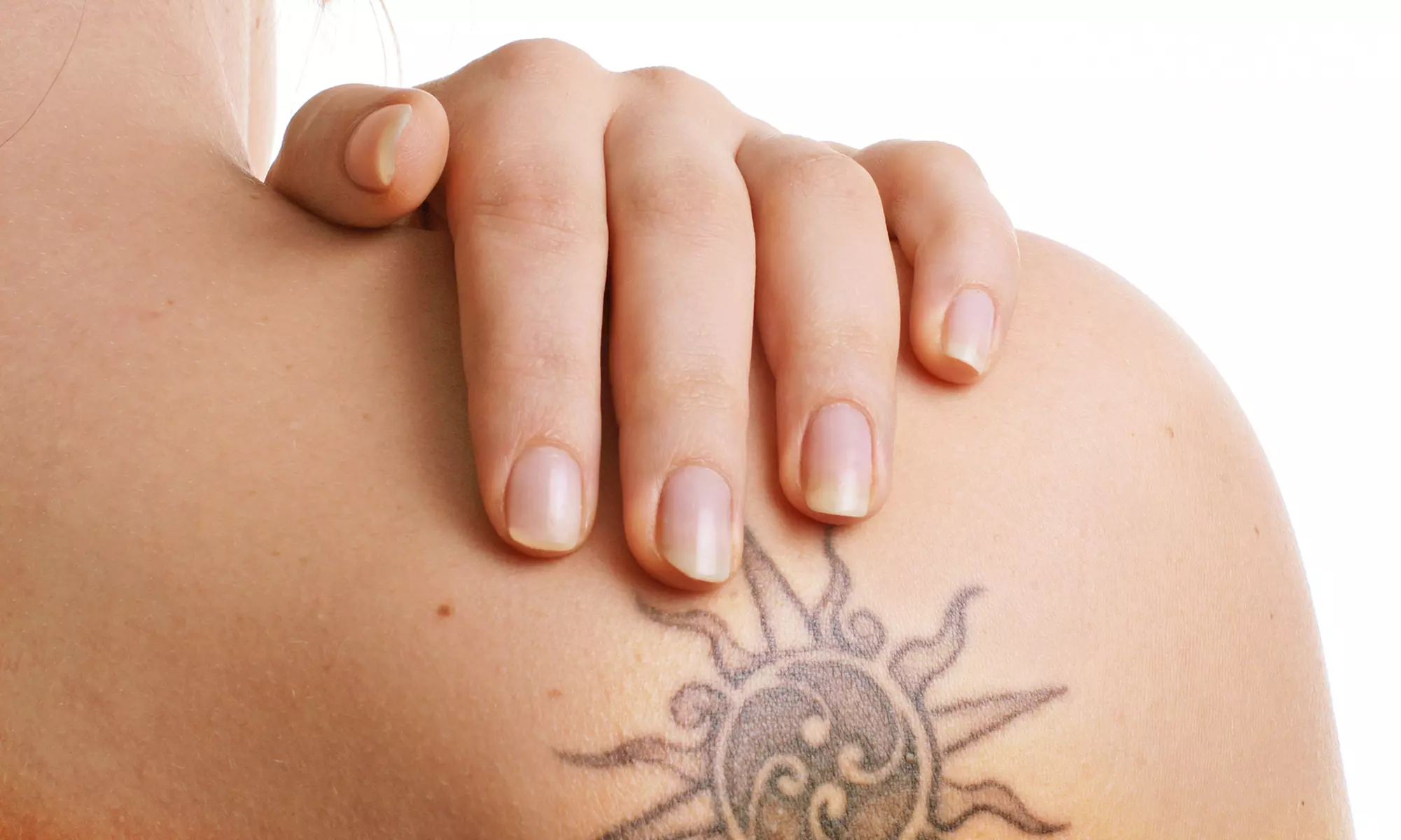 Six Months of Tattoo-Removal Treatments for One Tattoo at EB Medical Spa & Laser Center (Up to 77% Off) - Primary Image