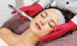 Achieve Radiant Skin with One or Two Microneedling Treatments