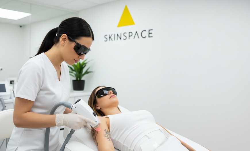 Image 1: Laser Tattoo Removal Session at SkinSpaceUK