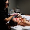 Image 8: Radio Frequency Skin Tightening at APEX Performance medical spa