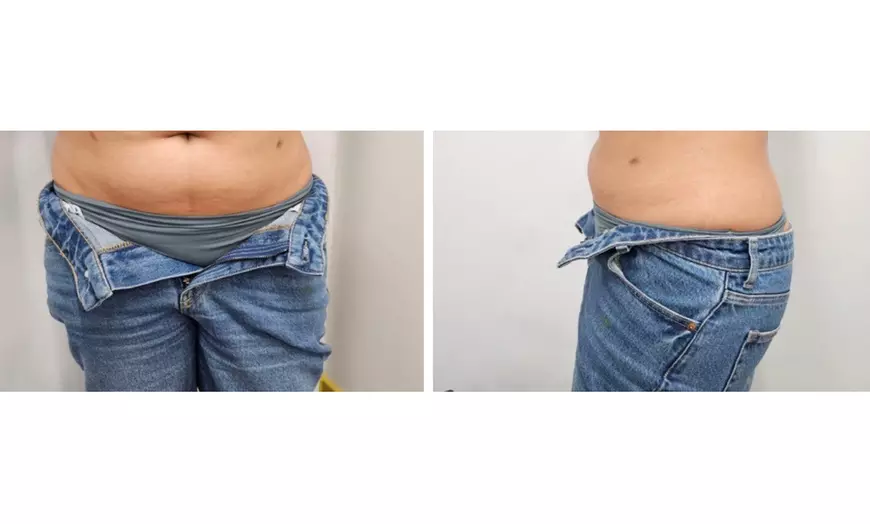 Image 8: Enjoy Pressotherapy Lymphatic Massage, RF Tightening, or Cavitation!