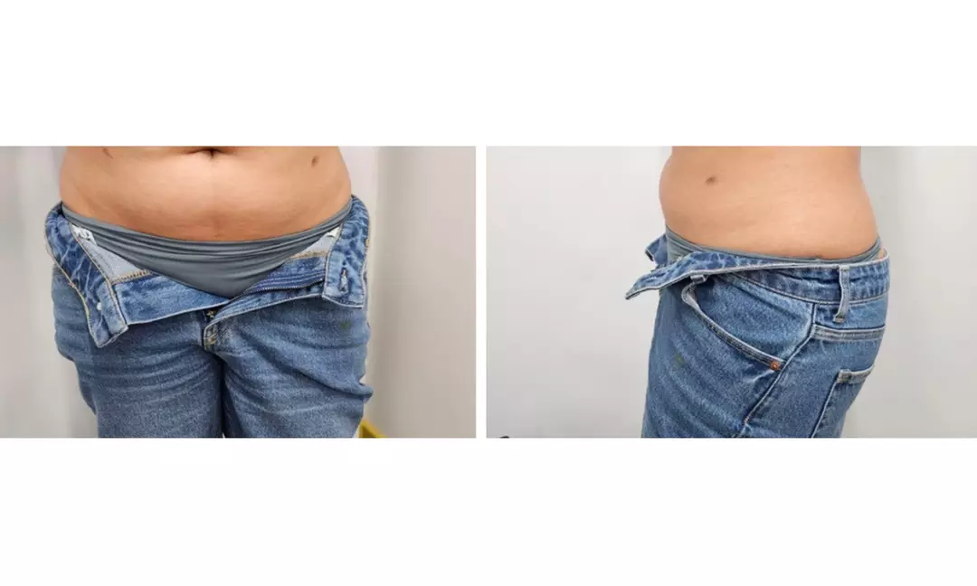 Enjoy Pressotherapy Lymphatic Massage, RF Tightening, or Cavitation!