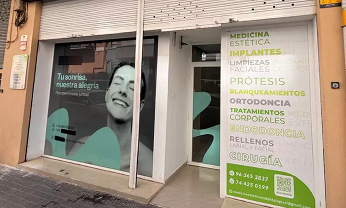 Higiene bucal con ultrasonidos y revisión y opción a empaste