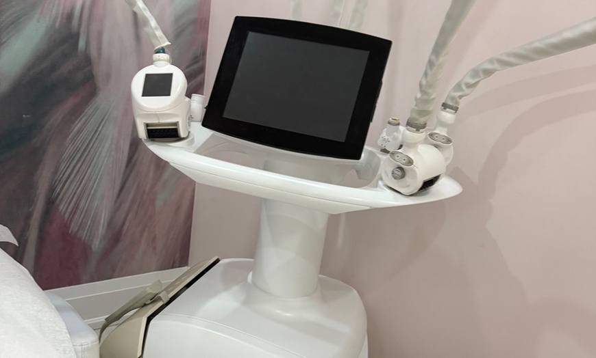 Image 4: Revitalize Your Skin with One, Two or Three PRP Micro-needling Session