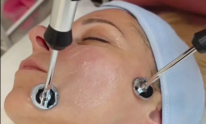60-Minute 1, 3, or 5x Cold Plasma Facial (Acne or Anti-Aging)