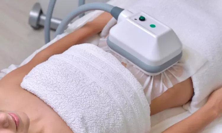 Recupera tu figura con sesiones de criolipólisis con presoterapia