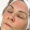 Image 3: HydraFacial with Optional Radio Frequency for Hydrated & Radiant Skin