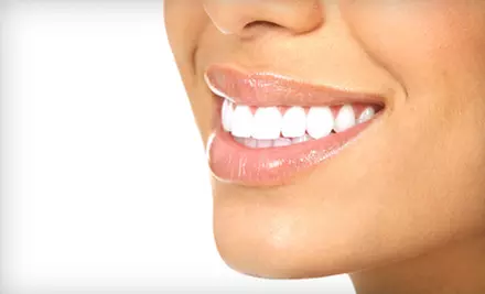 One or Two 15-Minute Teeth-Whitening Sessions at Smile Labs (Up to 52% Off) - Primary Image