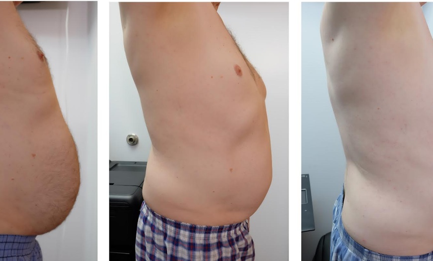 Image 5: Transform Your Body w/ 2, 4 or 6 Ultrasonic Fat & Cellulite Treatments