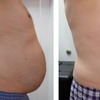 Image 5: Transform Your Body w/ 2, 4 or 6 Ultrasonic Fat & Cellulite Treatments