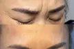 Up to 46% Off on Injection - Botox at Bayridge Beauty - Second Medium