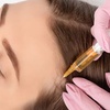 Image 3: PDO Thread Lifts for Mid-Face/Jawline Area with One Barbed Thread/Side
