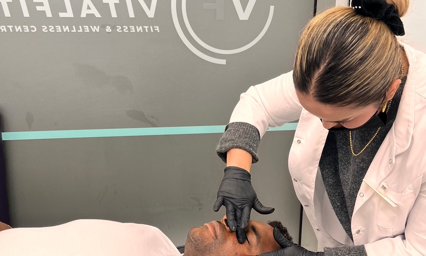 Image 3: Up to 60% Off on Micro-Needling at IV Vital Health