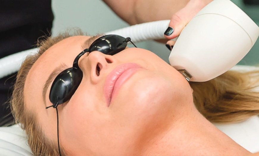 Image 8: 1 o 3 sesiones de tratamiento láser para manchas y acné