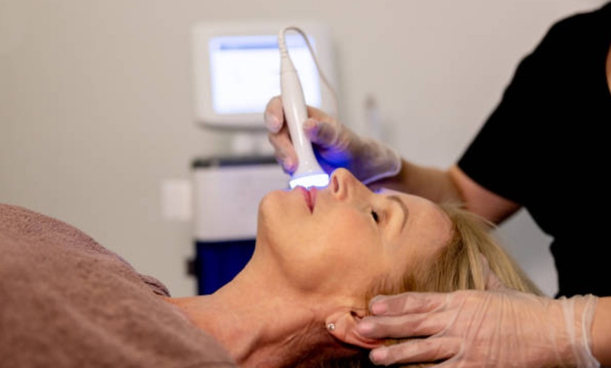 Image 3: Radiofrecuencia facial con bomba de hidratación o velo de colágeno