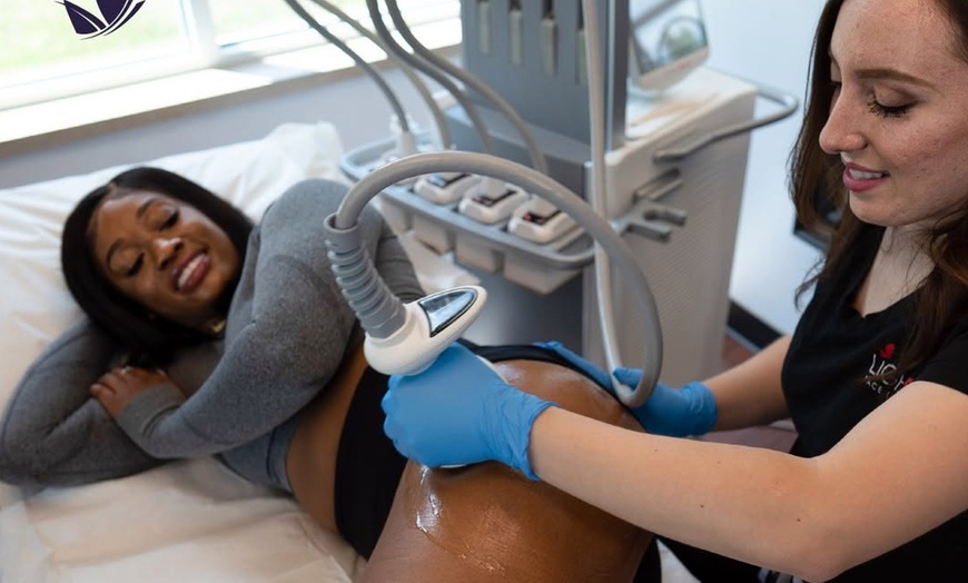 Image 2: One or Three Venus Legacy RF Skin Tightening Treatments