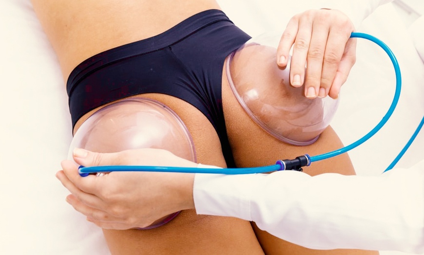 Image 1: Transform with One or Four Sessions of Vacuum Brazilian Butt Lift