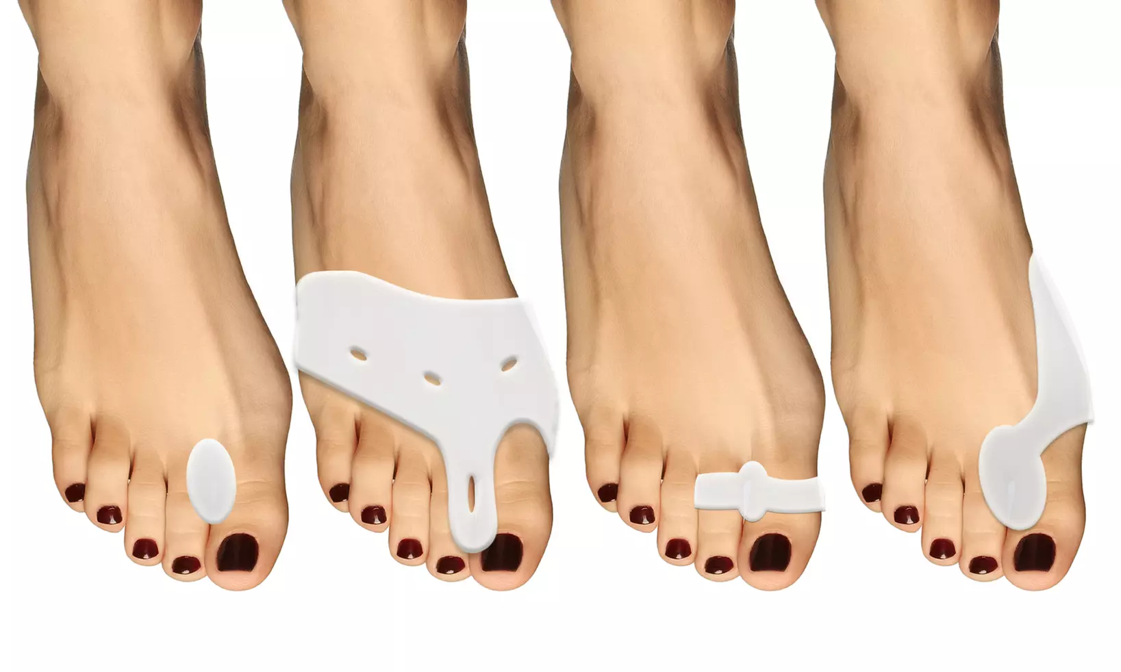 10-delige gezondheidskit voor tenen 'Bunion Buddy'