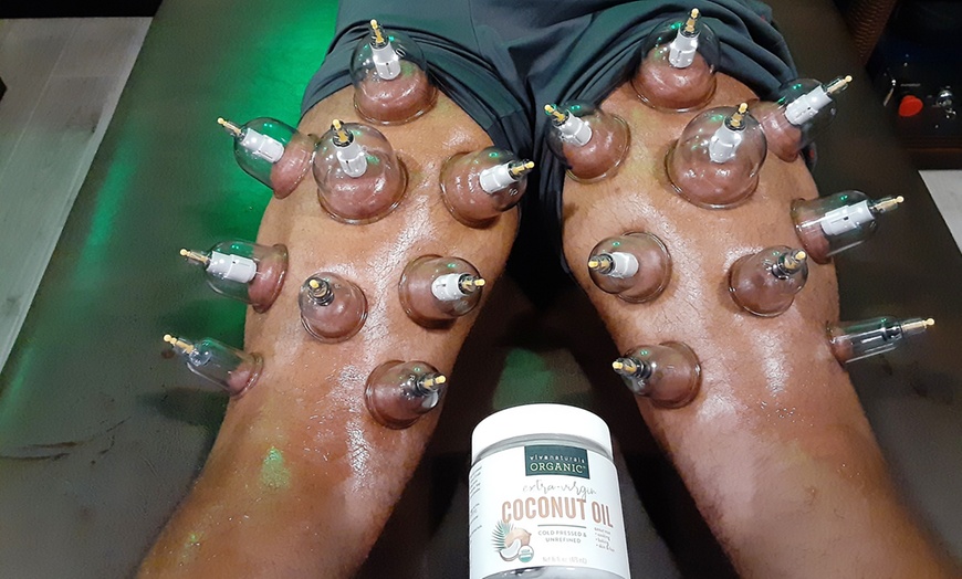 Image 3: Up to 37% Off on Cupping at Beyond The Gym Fitness