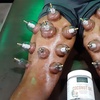 Image 3: Up to 37% Off on Cupping at Beyond The Gym Fitness