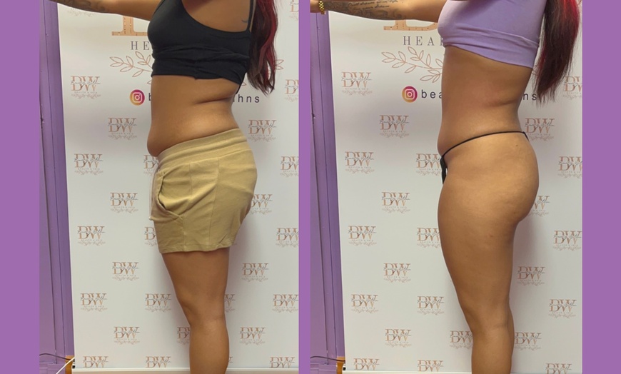 Image 4: One, Three, or Six Mommy Makeover Sessions or Snatched To The Max
