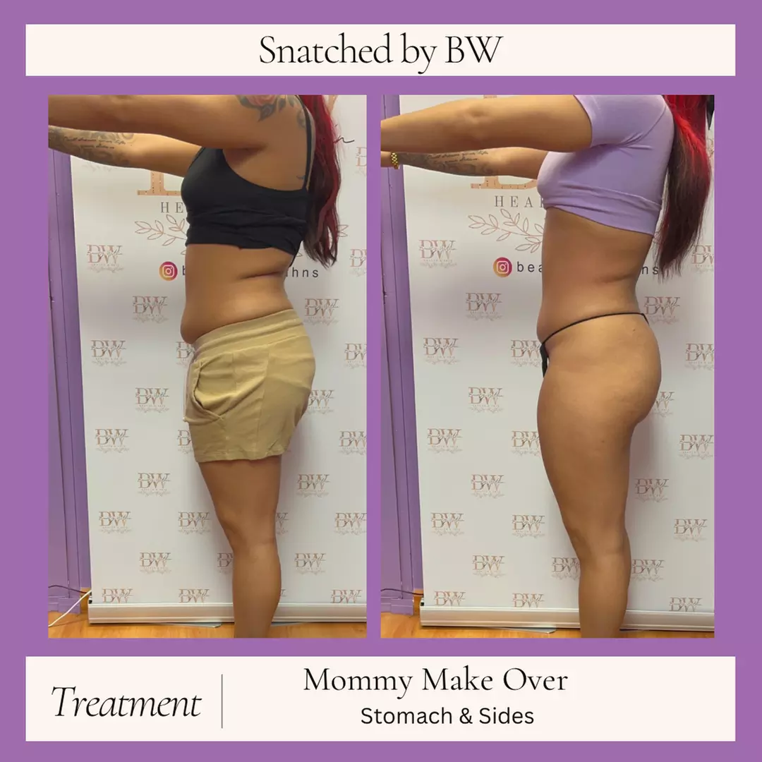 One, Three, or Six Mommy Makeover Sessions or Snatched To The Max