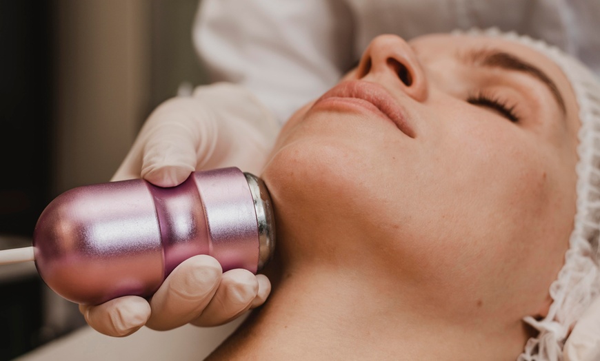 Image 4: 1, 2, 3 o 4 sesiones de radiofrecuencia facial de cara y cuello 