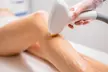 Smooth Skin Awaits with Six Sessions for Laser Hair Removal on Choice of Area (Up To 72% Off) - Second Medium