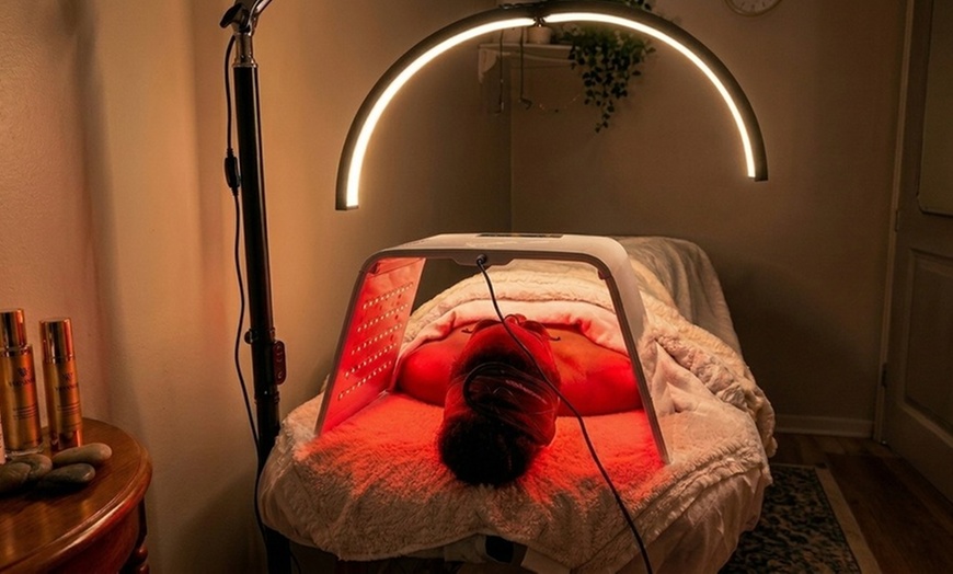 Image 5: Chemical Peel & Classic Facial Sessions for Refreshed, Glowing Skin