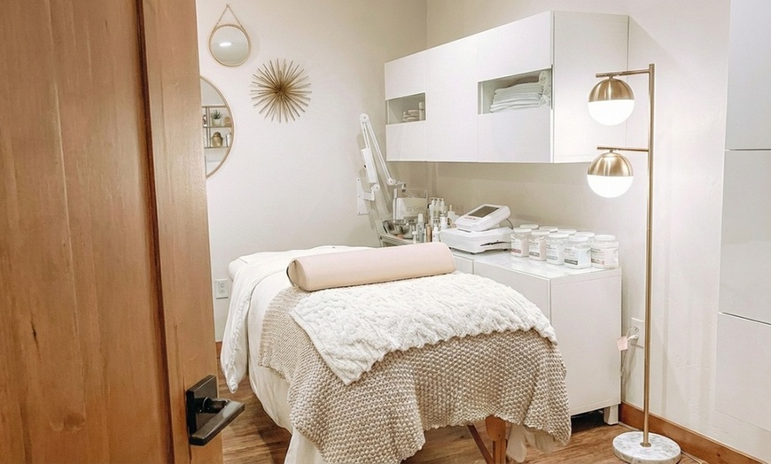 Image 2: Enhance Your Glow with 1, 2, or 3 Chemical Peels