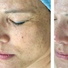 Image 9: Up to 55% Off on Facial - Chosen by Customer at Rise Skin Spa