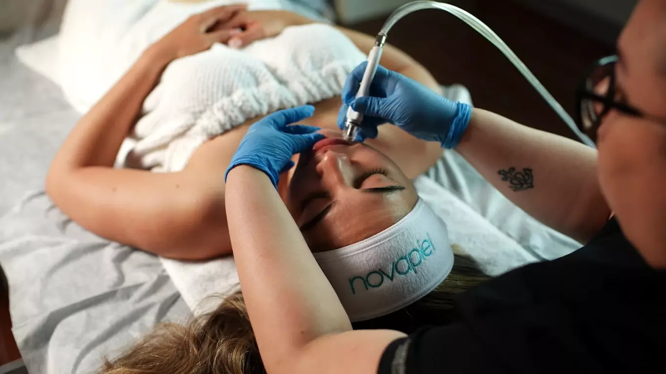 20, 40, or 60 Units of Botox for a Refreshed, Youthful Look 