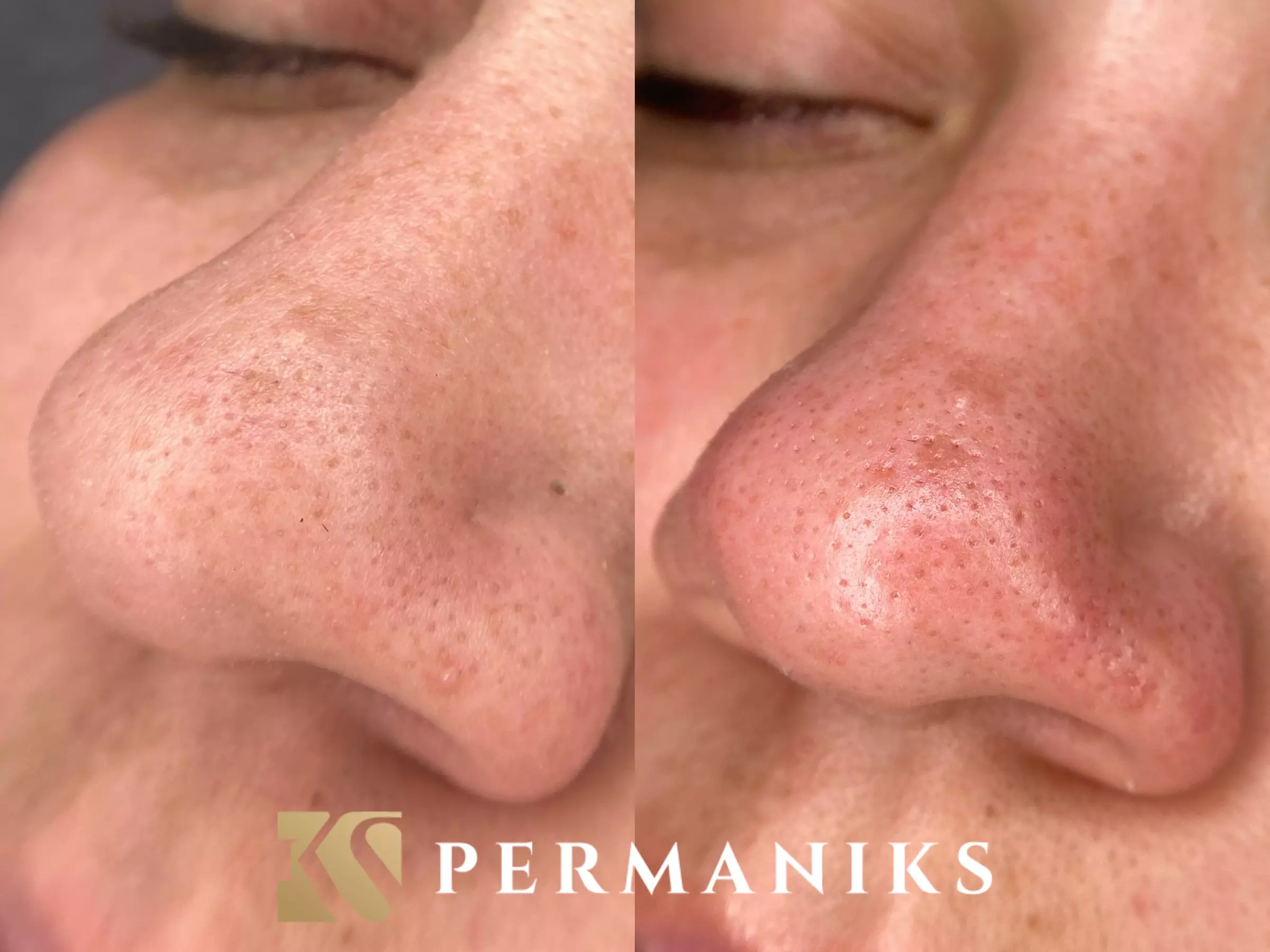 Up to 30% Off on Eyelash Lift & Tint Treatment at Permaniks