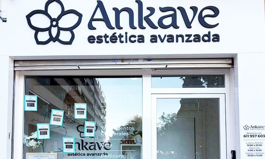 Image 4: Exosomas con Dermapen en rostro completo, una o dos sesiones