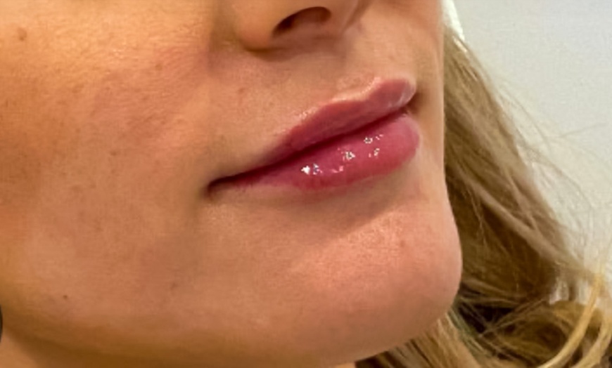 Image 2: Refresh Your Skin with 1 or 3 Sessions of Relaxing Anti-Aging Facial