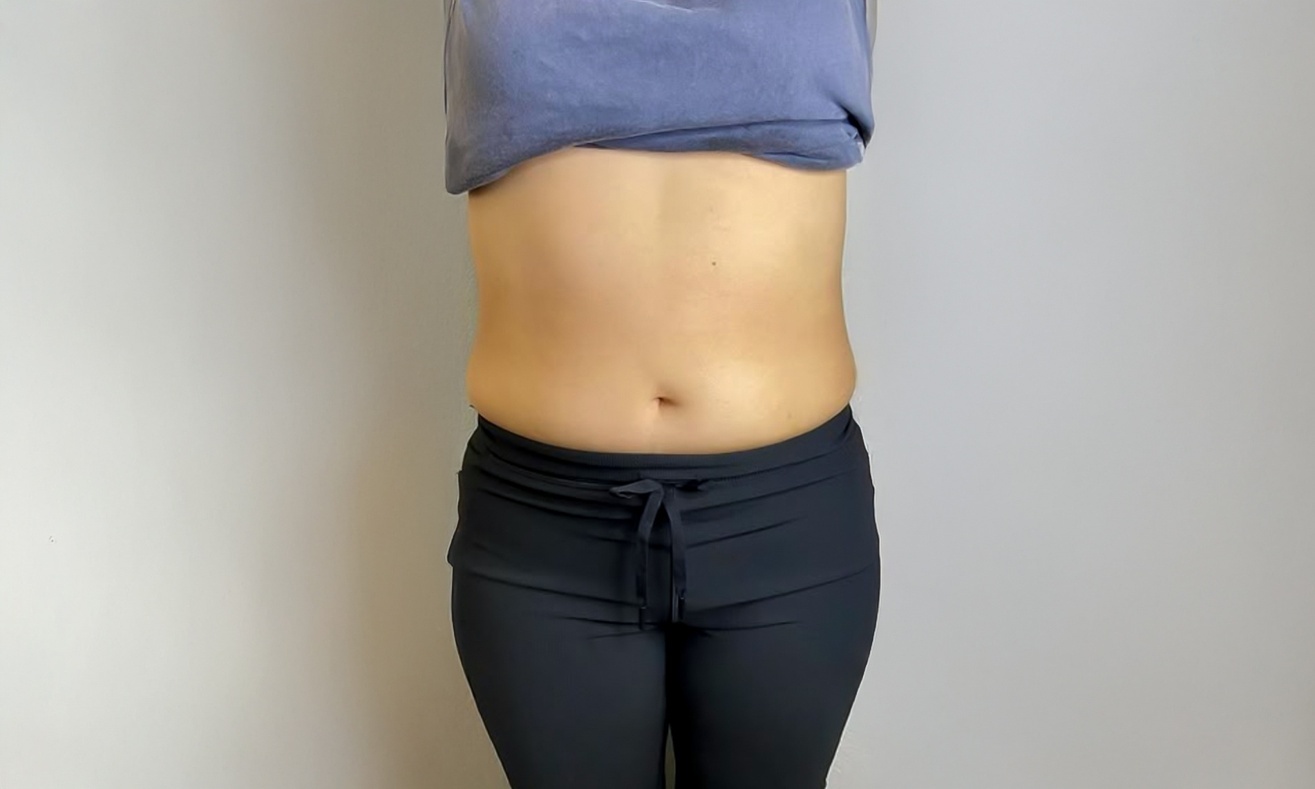 Transform with One or Three 50-Minute Body Contouring Sessions