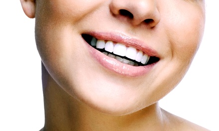 One or Two InOffice LED TeethWhitening Treatments at Endearing Smiles (Up to 74% Off)