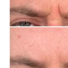 Image 1: 20, 40, or 60 Units of Letybo® Treatments for Smoother Skin